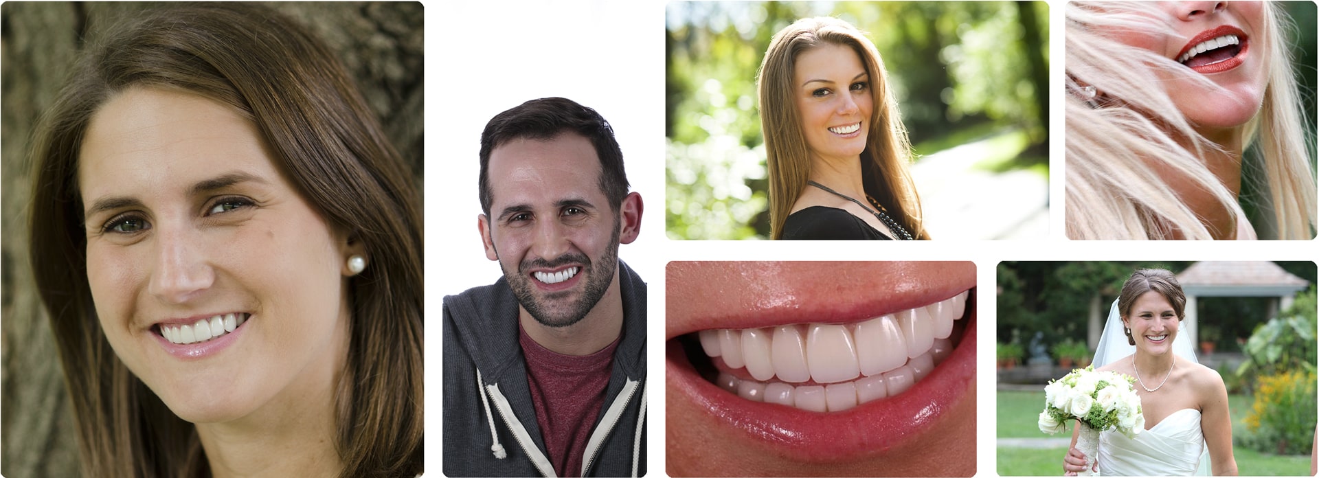 A collage of our Stelzer Dental patients showing off their new smiles