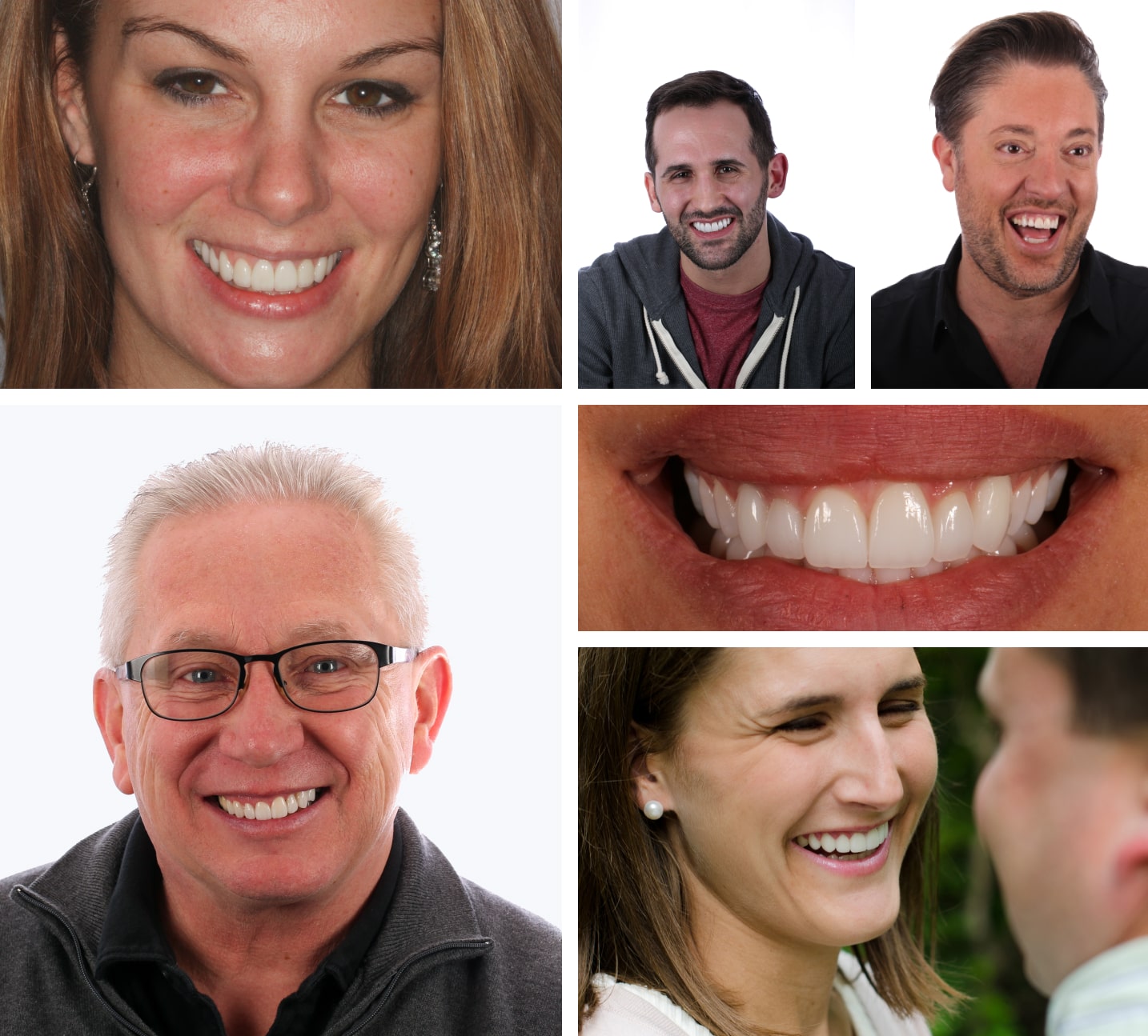 A collage of the beautiful new smiles of Dr. Stelzer's patients
