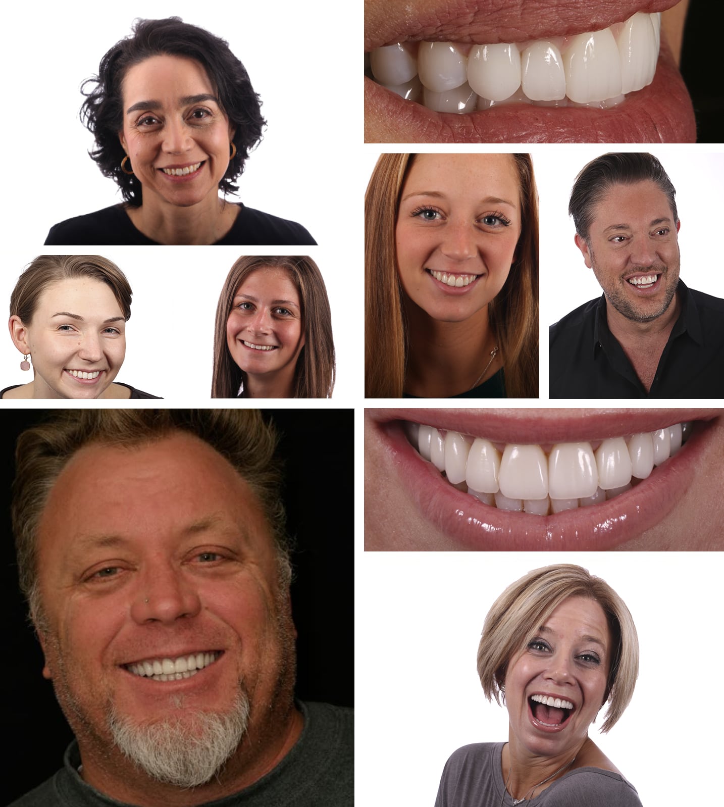 A collage of the beautiful new smiles of Dr. Stelzer's patients